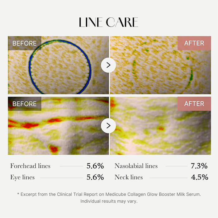 medicube collagen glow booster serum 15 ml before after